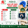 Những lỗi thường gặp khi lấy dấu phục hình và cách hạn chế