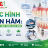 Phục Hình Toàn Hàm: Những Điều Nha Khoa Cần Biết | Mỹ Luân Dental Lab