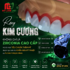 Không Phải Đá – Đây Là Răng Kim Cương | Lab Mỹ Luân