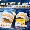 Răng Sứ Lava Esthetic & Lava Plus: Khác Biệt Bác Sĩ Cần Biết