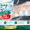 Răng Kim Cương Zirconia Cao Cấp: Giải Pháp Nâng Tầm Thương Hiệu Nha Khoa