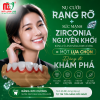 Răng Kim Cương Full Sườn Zirconia Nguyên Khối | Mỹ Luân Dental Lab