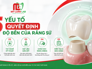 5 Yếu Tố Quyết Định Độ Bền Của Răng Sứ | Mỹ Luân Dental Lab