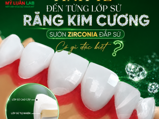 Răng Kim Cương Sườn Zirconia Đắp Sứ Thẩm Mỹ | Mỹ Luân Dental Lab