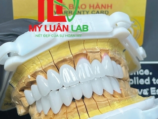 Phục Hình Sứ Lava Plus