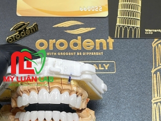 Phục Hình Sứ ORODENT 