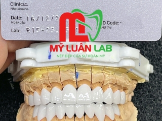 Phục Hình Sứ VENUS