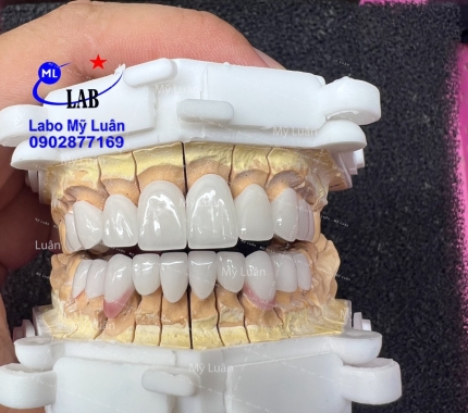 Labo luôn tận tâm để mang đến những dòng sản phẩm tốt nhất cho khách hàng.