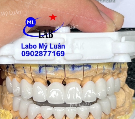 Một ca thẩm mỹ cực kỳ dễ thương vừa được hoàn thành.