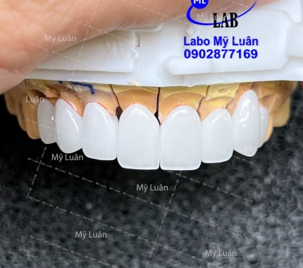 Siêu trắng luôn nha mọi người ơi. Chúc mọi người đầu tuần nhiều năng lượng nha.