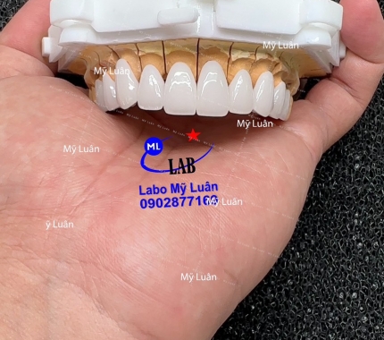 Form dáng và màu sắc là hai yếu tố quan trọng tạo chất lượng.