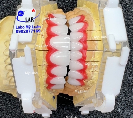 Khi khách hàng nói thích form giọt nước và màu trắng trong tự nhiên thì đây là kết quả ạ. Kính chúc quý khách thứ 6 vui vẻ ạ.