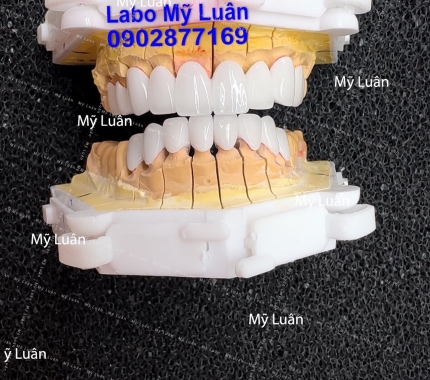 Trắng trong veo luôn nhe quý khách ơi. Form dáng thì theo kiểu hiện đại nhe quý khác.h