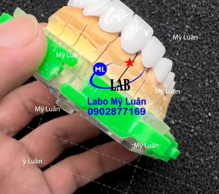 Trắng không tùy vết luôn nhe quý khách hihi