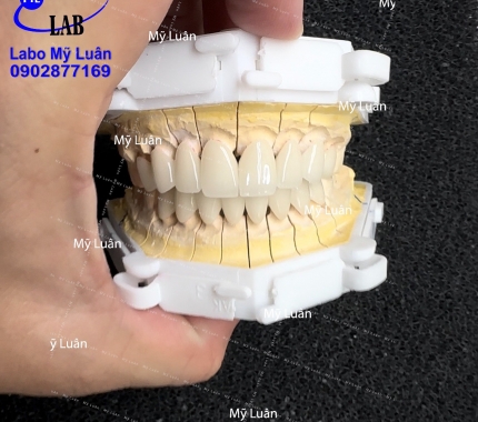  Sứ Lava màu 1M1 nha quý khách, màu siêu tươi siêu tự nhiên luôn ạ