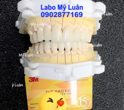 Sứ Lava thẩm mỹ màu 1M1 nha quý khách, màu nhìn tự nhiên và tươi lắm ạ.