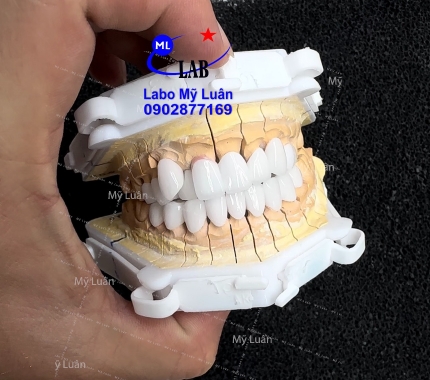 Màu sắc, form dáng, răng khểnh, tất cả đều nằm trong một khung hình. Thứ năm vui vẻ ạ.