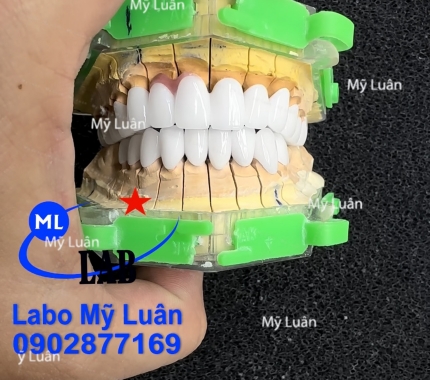 Những ca đầu năm ạ, khách thích trắng để đón chào năm mới ạ.