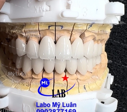 Trắng trong tự nhiên luôn nhe quý khách. Hi Thứ 3 vui vẻ ạ.