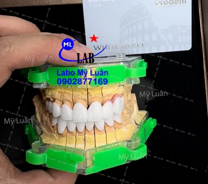 Orodent một dòng sứ cao cấp xuất xứ từ Itali ạ, màu sắc tươi mới luôn ạ