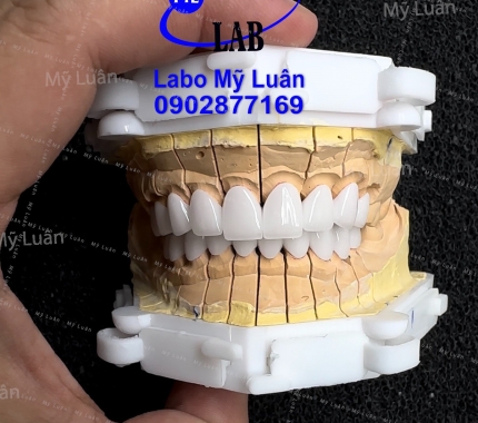 Thứ sáu vui vẻ. Sứ zico màu 0M1 trong tự nhiên