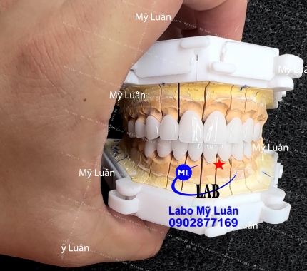 Thứ 5 vui vẻ