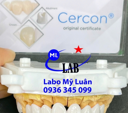 CERCON HT sự lựa chọn hoàn hảo.