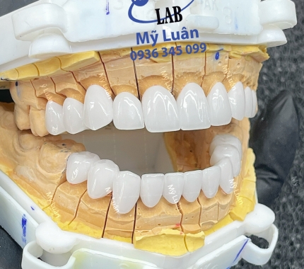   Thứ bảy với nụ cười với chiếc răng khễnh duyên dáng.