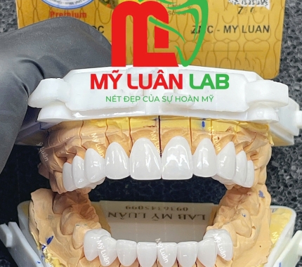 Răng sứ thẩm mỹ LAB MỸ LUÂN luôn là sự lựa chọn đúng đắn.