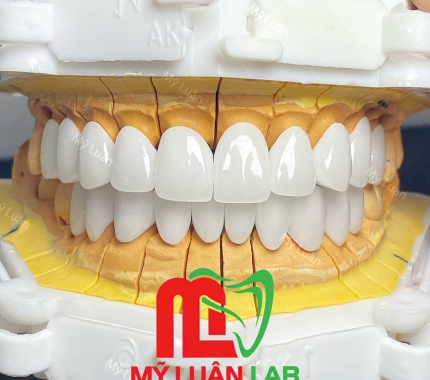 Lại một ca thẩm mỹ của lab mỹ luân