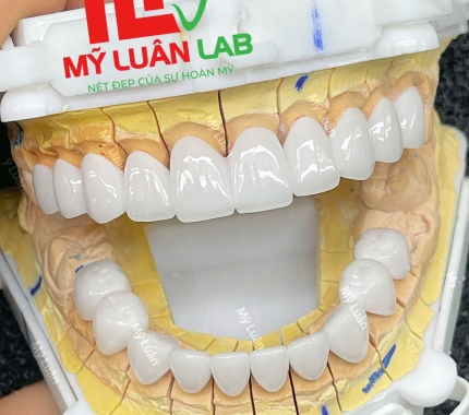 Lại tuyệt vời với 1 kiệt tác thẩm mỹ.