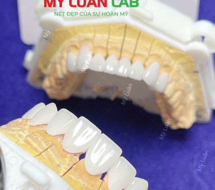 Trở lại sau 1 thời gian quá bận rộn.
