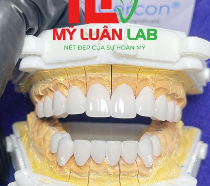 Thêm một sản phẩm mới đến từ Lab Mỹ Luân và Sứ Cercon HT.