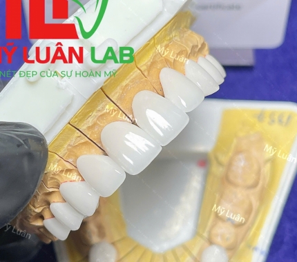 Thẩm mỹ tuyệt vời LAB MỸ LUÂN