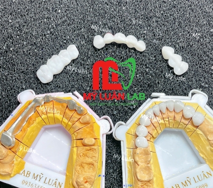 Mỗi sản phẩm là một công thức khác nhau