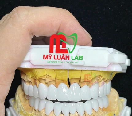 Công việc mỗi ngày của LAB MỸ LUÂN.